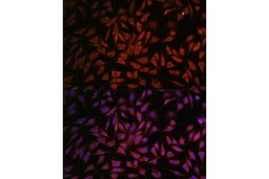 Immunofluorescence analysis of L929 cells using NOB1 antibody (ABIN7270109) at dilution of 1:100. (NOB1 antibody  (AA 1-230))