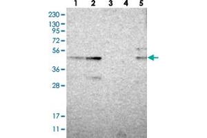 Western blot analysis of Lane 1: RT-4, Lane 2: U-251 MG, Lane 3: Human Plasma, Lane 4: Liver, Lane 5: Tonsil with ZNF397OS polyclonal antibody  at 1:250-1:500 dilution. (ZSCAN30 antibody)