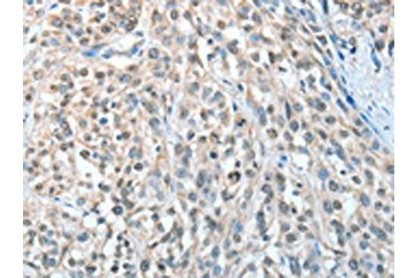 AGBL3 antibody