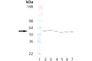 Western blot analysis of PDI: Lane 1: MW marker, Lane 2: HeLa (HS) Lane 3: , Lane 4: Vero (HS), Lane 5: 3T3 (HS), Lane 6: PC-12 (HS), Lane 7: CHO-K1 (HS) (P4HB antibody  (C-Term))