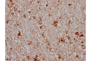 IHC image of ABIN7127628 diluted at 1:100 and staining in paraffin-embedded human brain tissue performed on a Leica BondTM system. (Recombinant Monoamine Oxidase B antibody)
