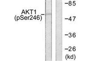 Western blot analysis of extracts from HeLa cells treated with Etoposide 25uM 24h, using Akt (Phospho-Ser246) Antibody. (AKT1 antibody  (pSer246))