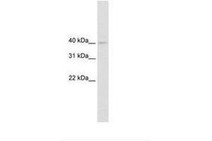 Image no. 1 for anti-Nudix (Nucleoside Diphosphate Linked Moiety X)-Type Motif 9 (NUDT9) (AA 121-170) antibody (ABIN6735454) (NUDT9 antibody  (AA 121-170))
