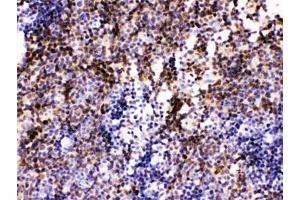 IHC testing of FFPE mouse lymph node with PAX2 antibody. (PAX2A antibody)