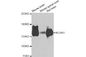 Western blot analysis of extracts of various cell lines, using NCAM1 antibody (ABIN5975670) at 1/1000 dilution. (CD56 antibody)