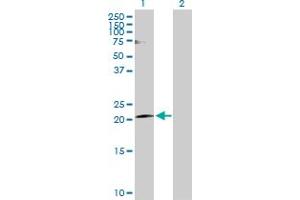 Western Blot analysis of CLDN20 expression in transfected 293T cell line by CLDN20 MaxPab polyclonal antibody. (Claudin 20 antibody  (AA 1-219))