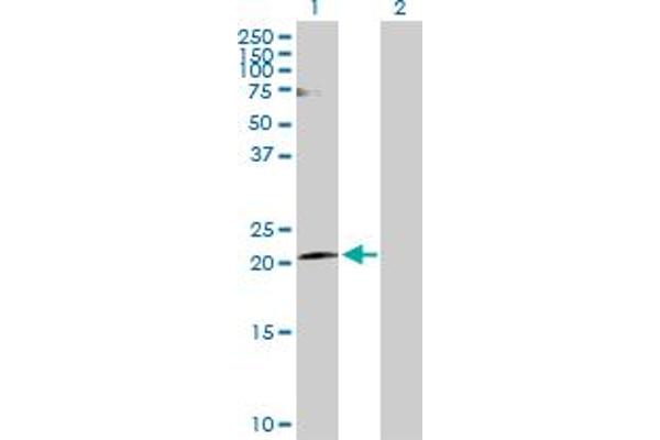 Claudin 20 antibody  (AA 1-219)