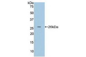 Detection of Recombinant FcgRI, Human using Polyclonal Antibody to Cluster Of Differentiation 64 (CD64) (FCGR1A antibody  (AA 35-235))