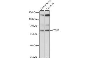 Western blot analysis of extracts of various cell lines, using CCT6B antibody (ABIN7270709) at 1:1000 dilution. (CCT6B antibody  (AA 120-340))