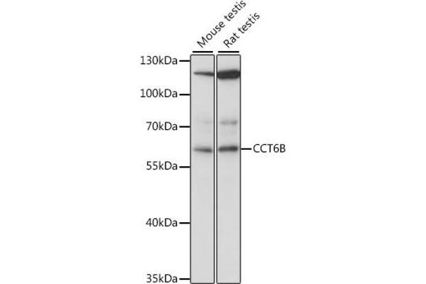 CCT6B antibody  (AA 120-340)