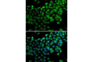 Immunofluorescence analysis of A-549 cells using SYNCRIP antibody. (SYNCRIP antibody  (AA 1-200))