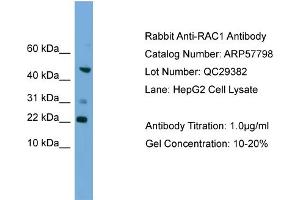 WB Suggested Anti-RAC1  Antibody Titration: 0. (RAC1 antibody  (Middle Region))