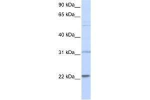 WB Suggested Anti-CDC42 Antibody Titration:  0. (CDC42 antibody  (N-Term))