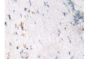 Immunohistochemistry (IHC) image for anti-Tumor Necrosis Factor alpha (TNF alpha) (AA 77-233) antibody (ABIN7429988)