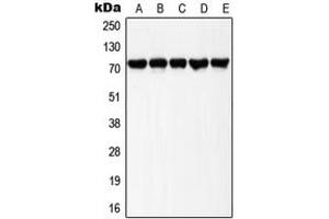 Western blot analysis of LIMK1/2 (pT508/505) expression in HeLa UV-treated (A), Raw264. (LIMK-1/2 (C-Term), (pSer505), (pSer508) antibody)