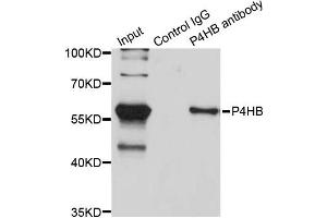 Immunoprecipitation analysis of 200ug extracts of SW620 cells using 3ug P4HB antibody.
