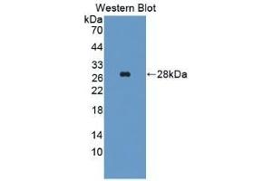 Detection of Recombinant ALT, Human using Monoclonal Antibody to Alanine Aminotransferase (ALT) (ALT antibody  (AA 255-492))