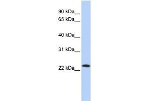 WB Suggested Anti-SDF2 Antibody Titration:  0. (SDF2 antibody  (Middle Region))