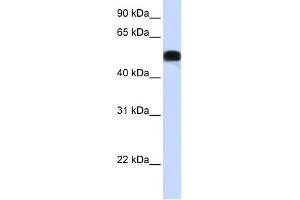 WB Suggested Anti-FOXA1 Antibody Titration: 0. (FOXA1 antibody  (N-Term))
