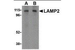 Western Blotting (WB) image for anti-Lysosomal-Associated Membrane Protein 2 (LAMP2) (C-Term) antibody (ABIN2478099) (LAMP2 antibody  (C-Term))