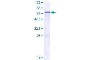 QTRT1 Protein (AA 1-358) (GST tag)