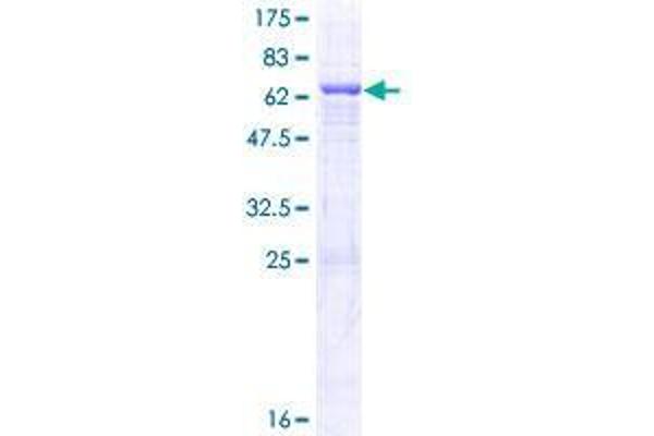 QTRT1 Protein (AA 1-358) (GST tag)