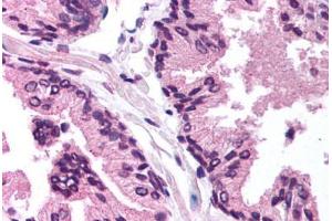Image no. 1 for anti-Transforming Growth Factor beta 1 Induced Transcript 1 (TGFB1I1) (AA 179-228) antibody (ABIN6736433)