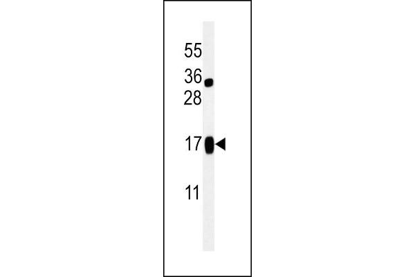 LIMD2 抗体  (N-Term)