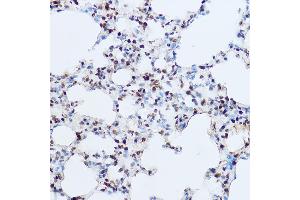 Immunohistochemistry of paraffin-embedded mouse lung using OGT Rabbit pAb (ABIN3022707, ABIN3022708, ABIN3022709 and ABIN6219152) at dilution of 1:100 (40x lens).
