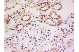 Formalin-fixed and paraffin embedded human kidney labeled with Anti-GRB 14 Polyclonal Antibody, Unconjugated  at 1:200 followed by conjugation to the secondary antibody and DAB staining. (GRB14 antibody  (AA 221-320))