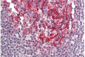 Human Small Intestine, Peyer's Patch (formalin-fixed, paraffin-embedded) stained with BIRC8 antibody ABIN214413 at 5 ug/ml followed by biotinylated goat anti-rabbit IgG secondary antibody ABIN481713, alkaline phosphatase-streptavidin and chromogen. (ILP-2 antibody  (N-Term))