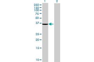 Western Blot analysis of EPM2A expression in transfected 293T cell line ( H00007957-T01 ) by EPM2A MaxPab polyclonal antibody. (EPM2A antibody  (AA 1-331))