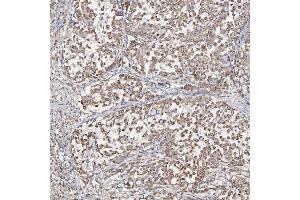 IHC analysis of ACAD9 using anti-ACAD9 antibody (ABIN7602670). (ACAD9 antibody  (AA 92-621))