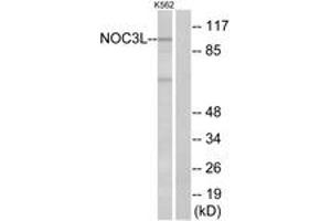 Western blot analysis of extracts from K562 cells, using NOC3L Antibody.