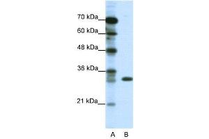 WB Suggested Anti-TSFM  Antibody Titration: 1. (TSFM antibody  (C-Term))