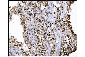 IHC analysis of KMT1B/SUV39H2 using anti-KMT1B/SUV39H2 antibody (ABIN7602135). (SUV39H2 antibody  (AA 6-410))