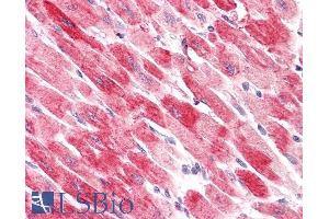 ABIN185454 (3. (Cofilin 2 antibody  (C-Term))