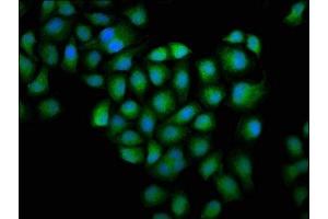 Immunofluorescence staining of Hela cells with ABIN7153749 at 1:100, counter-stained with DAPI. (Gelsolin antibody  (AA 28-782))