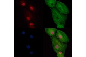 ABIN6265170 and ABIN6269368 staining  cells by IF/ICC.