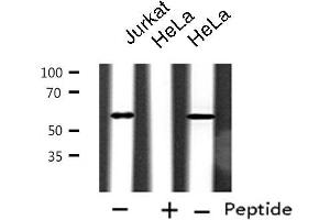 Western blot analysis of extracts from Jurkat/HeLa cells, using CYP2A6V2 antibody. (Cytochrome P450 2A6V2 antibody)