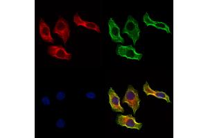 ABIN6264216 and ABIN6273297 staining Hela cells by IF/ICC. (PIK3IP1 antibody  (N-Term))