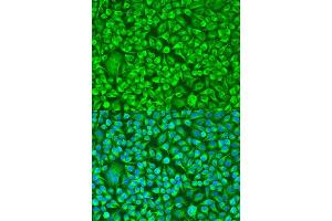 Immunofluorescence analysis of U2OS cells using TUBB8 antibody. (Tubulin, beta 8 antibody)