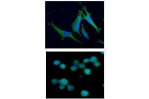 ICC/IF analysis of ALDOC in U87MG cells line, stained with DAPI (Blue) for nucleus staining and monoclonal anti-human ALDOC antibody (1:100) with goat anti-mouse IgG-Alexa fluor 488 conjugate (Green). (ALDOC antibody  (AA 1-364))