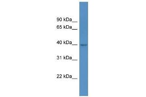 Western Blot showing HPDL antibody used at a concentration of 1 ug/ml against 293T Cell Lysate