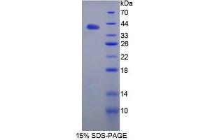 SDS-PAGE (SDS) image for Angiostatin (ANG) (AA 98-436) protein (His tag) (ABIN1078801) (Angiostatin Protein (ANG) (AA 98-436) (His tag))