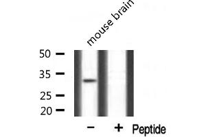 Western blot analysis of extracts from mouse brain, using Mlx antibody. (MLX antibody  (Internal Region))