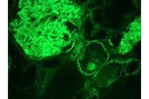 Immunohistochemistry on frozen section of human kidney (Integrin alpha 3a antibody)