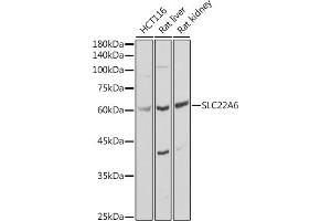 Western blot analysis of extracts of various cell lines, using SLC22 antibody (ABIN3022596, ABIN3022597, ABIN3022598 and ABIN6218932) at 1:1000 dilution. (SLC22A6 antibody)