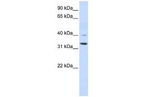 Crystallin Zeta antibody used at 1 ug/ml to detect target protein. (CRYZ antibody)