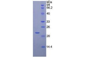 SDS-PAGE analysis of Chicken Interferon beta Protein. (IFNB1 Protein)